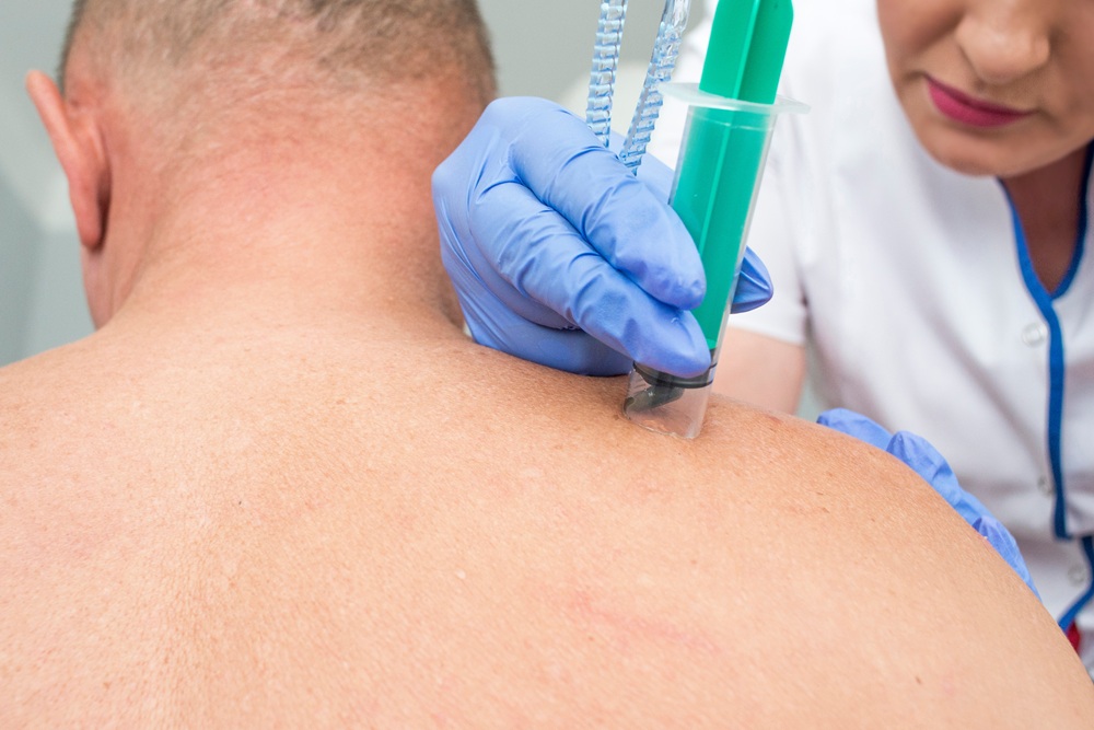 Leczenie botoksem Kraków